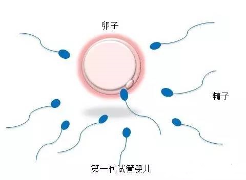 供卵代生套餐